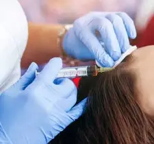 Mesotherapy for hair loss