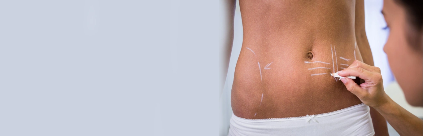 How Body Contouring Helps You Achieve a Toned Look Before the Festive Season