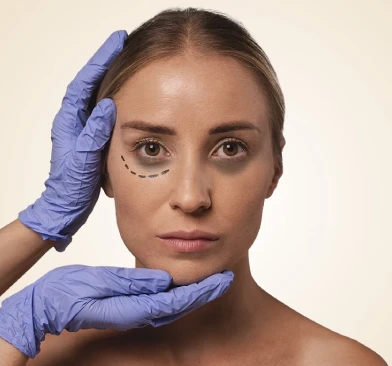 Dark Circles Under Eyes: Causes and Best Treatments