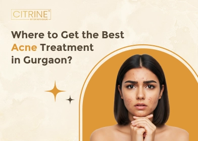 Where to Get the Best Acne Treatment in Gurgaon?