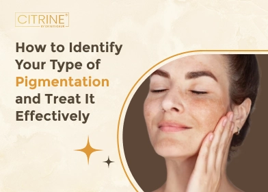 How to Identify Your Type of Pigmentation and Treat It Effectively