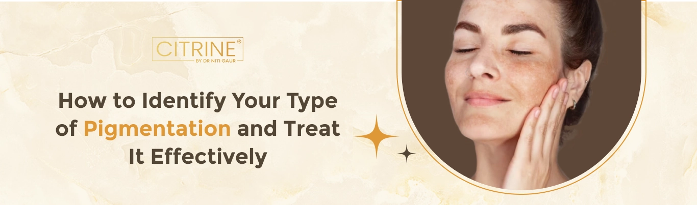 How to Identify Your Type of Pigmentation and Treat It Effectively