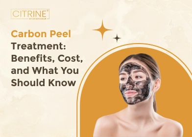 Carbon Peel Treatment: Benefits, Cost, and What You Should Know