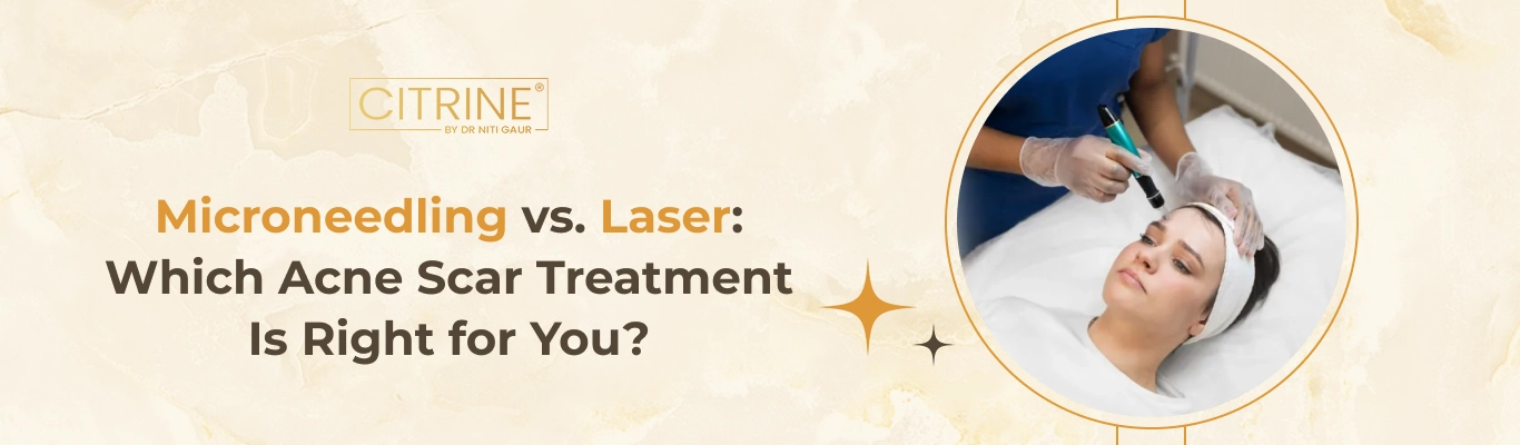 Microneedling vs. Laser: Which Acne Scar Treatment Is Right for You?