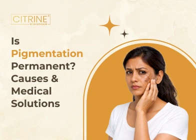 Is Pigmentation Permanent? Causes & Medical Solutions