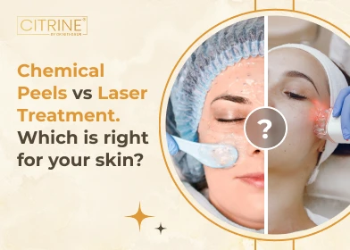 Chemical Peels vs Laser Treatment. Which is right for your skin?
