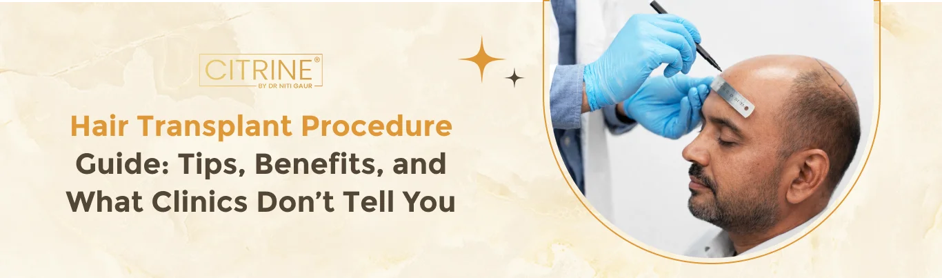 Hair Transplant Procedure Guide: Tips, Benefits, and What Clinics Don’t Tell You