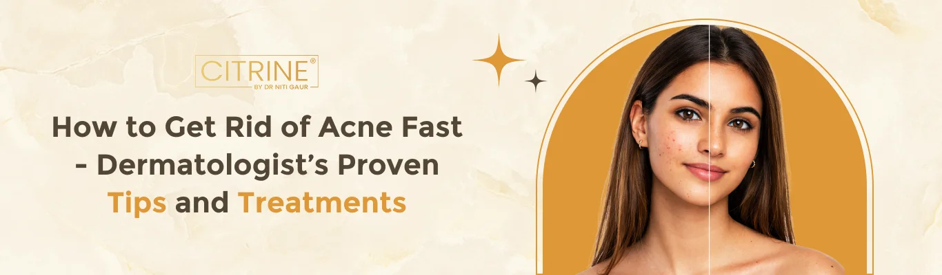 How to Get Rid of Acne Fast - Dermatologist’s Proven Tips and Treatments