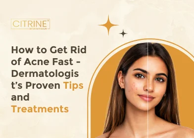 How to Get Rid of Acne Fast - Dermatologist’s Proven Tips and Treatments
