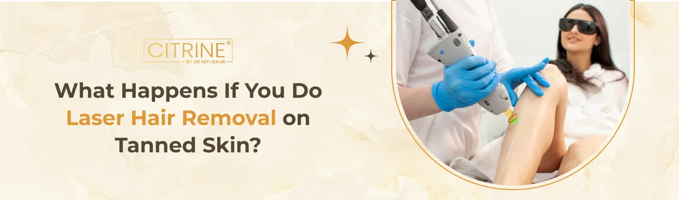 What Happens If You Get Laser Hair Removal on Tanned Skin?