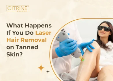 What Happens If You Get Laser Hair Removal on Tanned Skin?