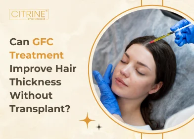 Can GFC Treatment Improve Hair Thickness Without Transplant?