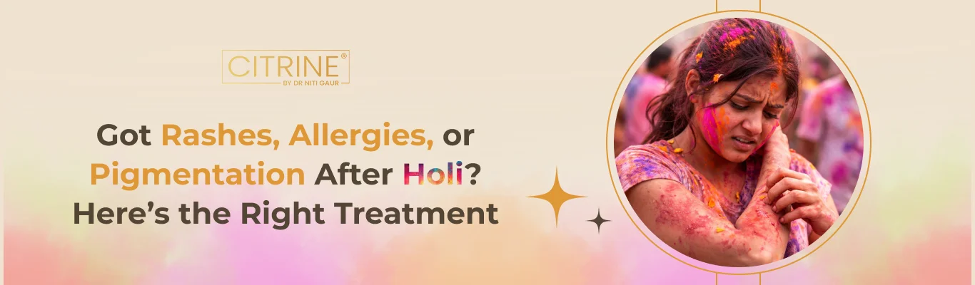 Got Rashes, Allergies, or Pigmentation After Holi? Here’s the Right Treatment