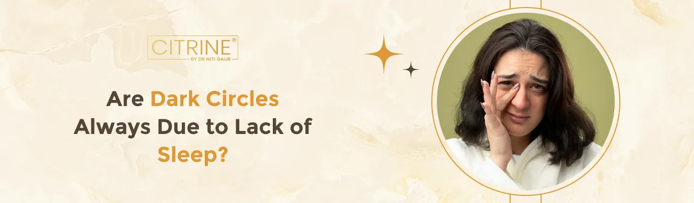 Are Dark Circles Always Due to Lack of Sleep?