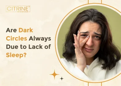 Are Dark Circles Always Due to Lack of Sleep?
