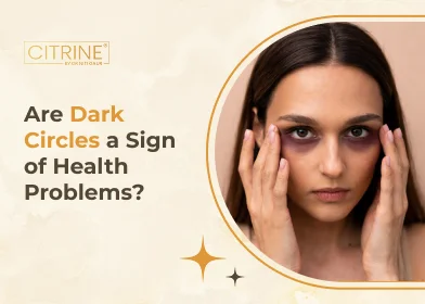 Are Dark Circles a Sign of Health Problems?