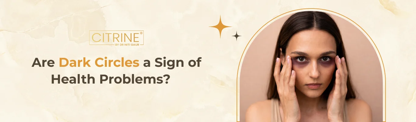 Are Dark Circles a Sign of Health Problems?