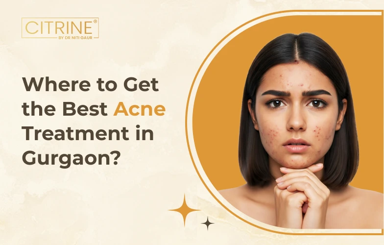 Where to Get the Best Acne Treatment in Gurgaon?