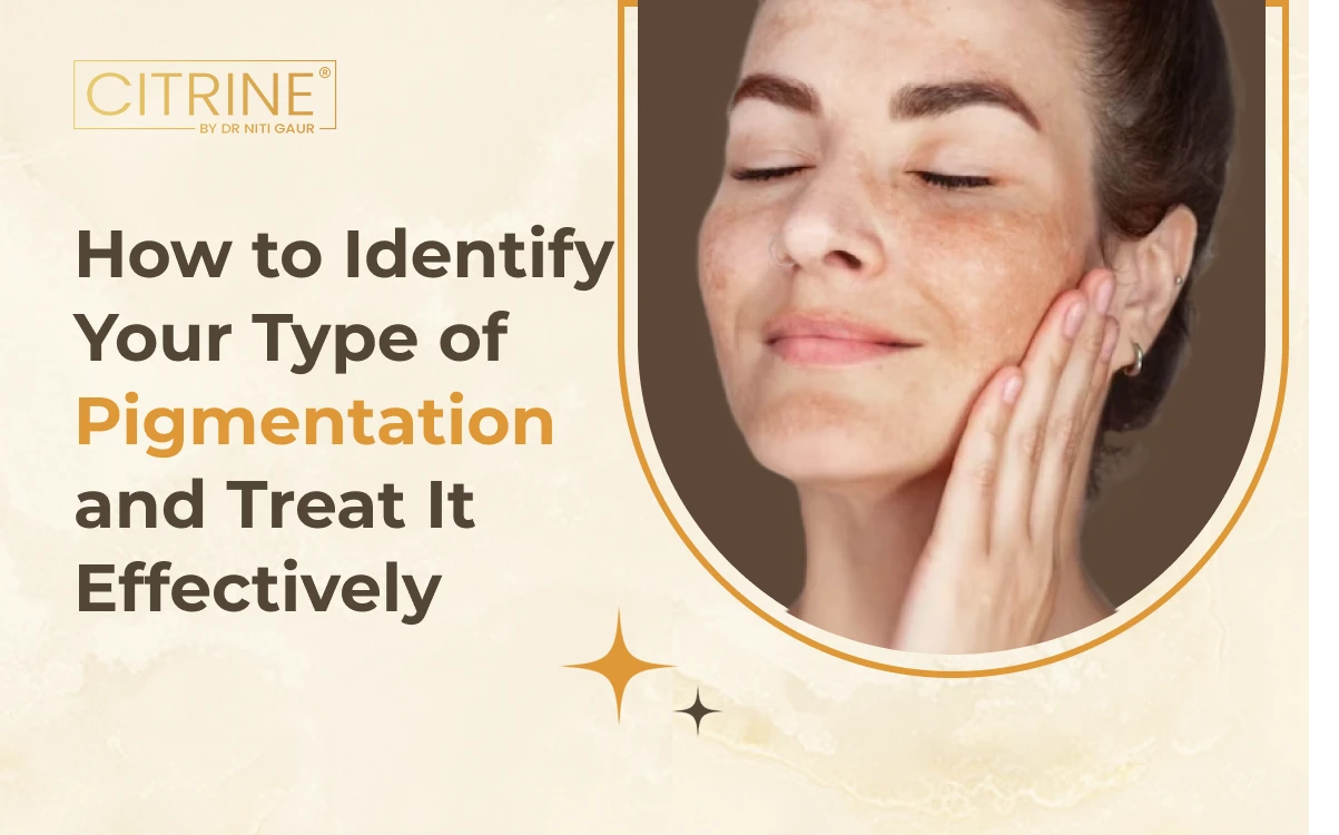 How to Identify Your Type of Pigmentation and Treat It Effectively