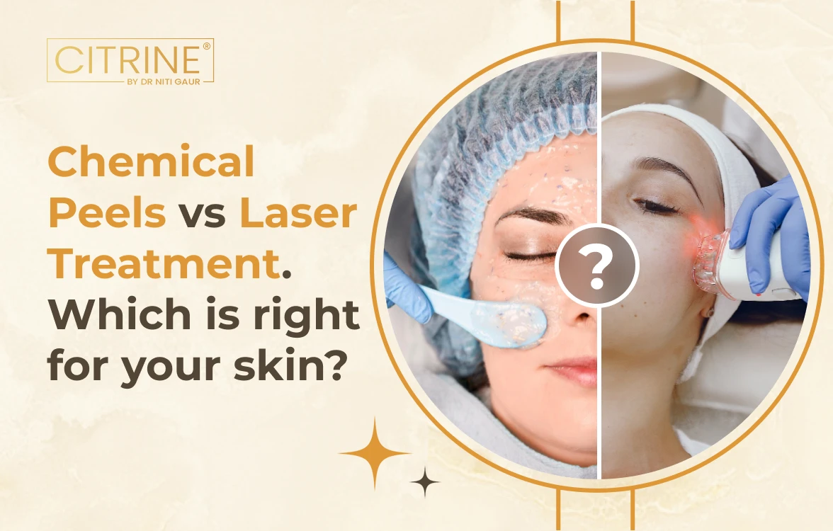 Chemical Peels vs Laser Treatment. Which is right for your skin?