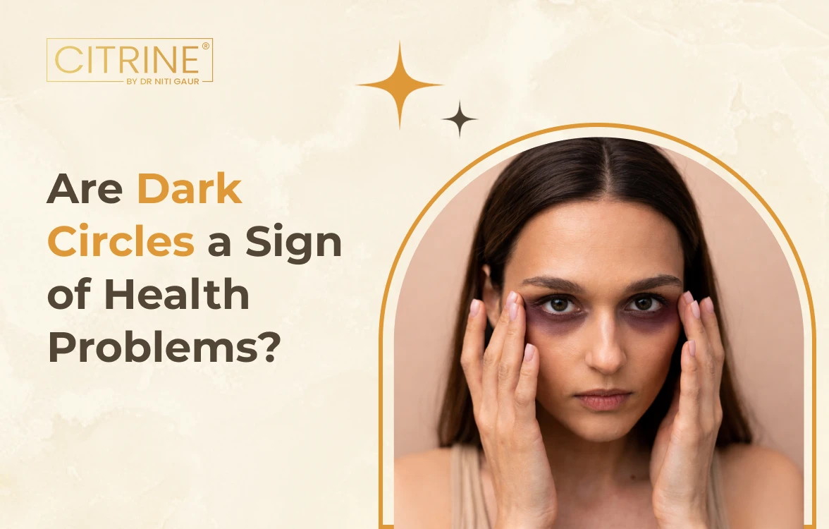 Are Dark Circles a Sign of Health Problems?
