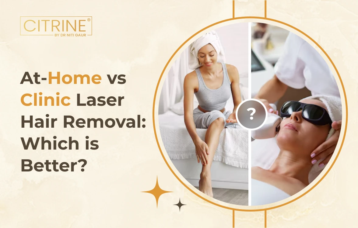 At-Home vs Clinic Laser Hair Removal: Which is Better?