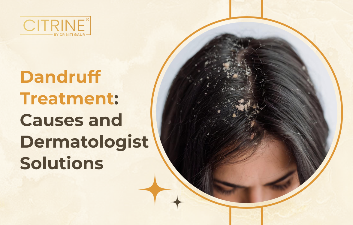 Dandruff Treatment: Causes and Dermatologist Solutions