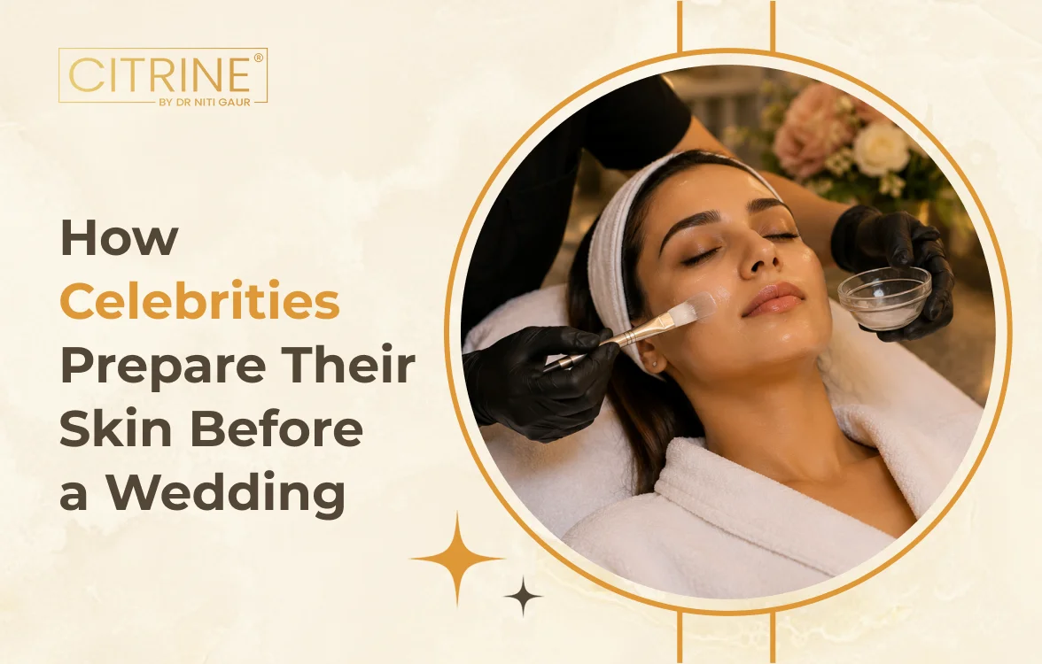 How Celebrities Prepare Their Skin Before a Wedding