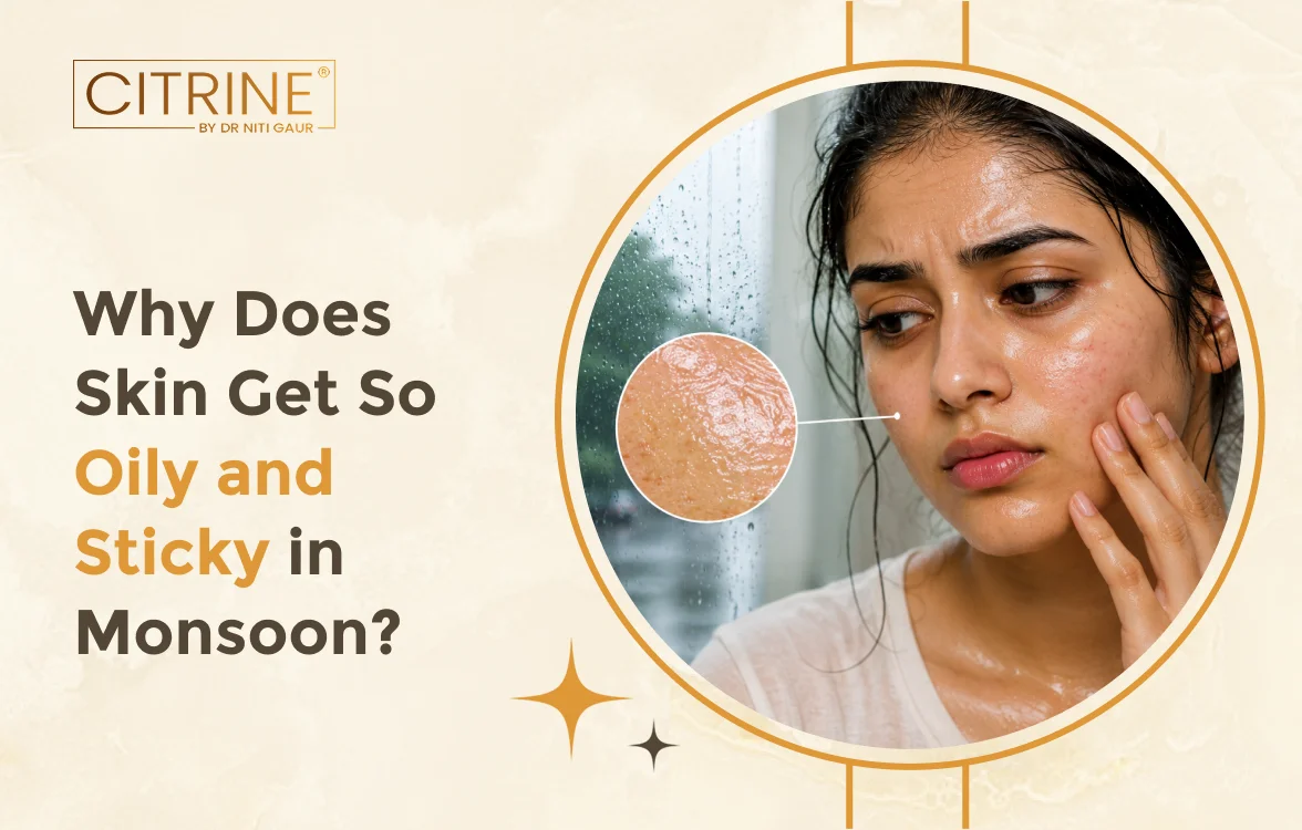 Why Does Skin Get So Oily and Sticky in Monsoon?