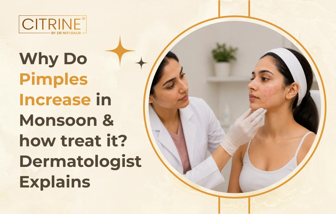 Why Do Pimples Increase in Monsoon & How to Treat It? Dermatologist Explains
