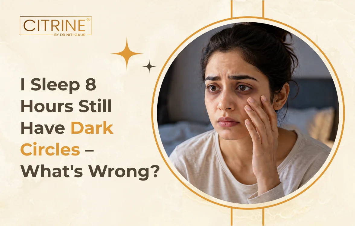 I Sleep 8 Hours Still Have Dark Circles – What's Wrong?