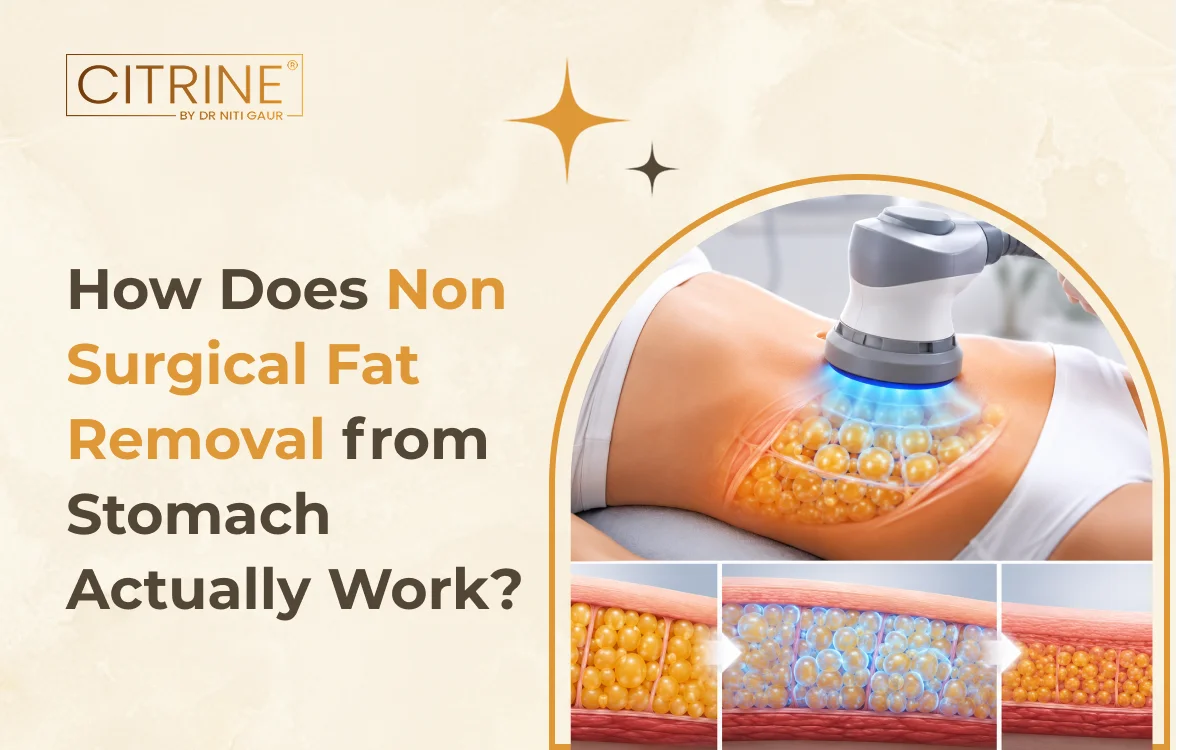 How Does Non Surgical Fat Removal from Stomach Actually Work?