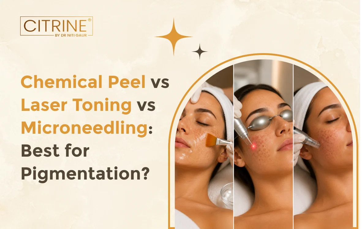 Chemical Peel vs Laser Toning vs Microneedling: Best for Pigmentation?