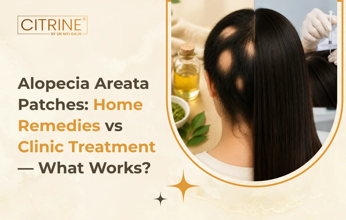 Alopecia Areata Patches: Home Remedies vs Clinic Treatment — What Works?