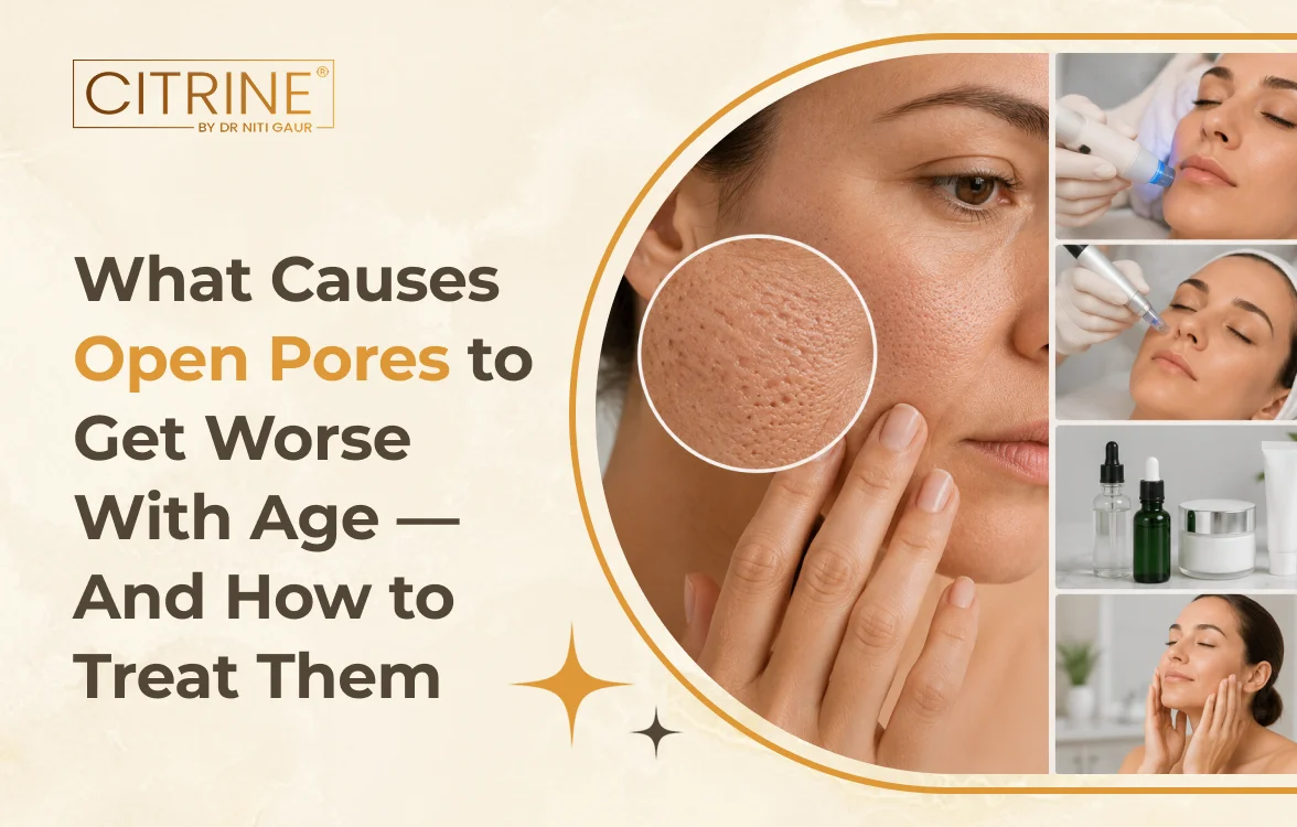What Causes Open Pores to Get Worse With Age — And How to Treat Them