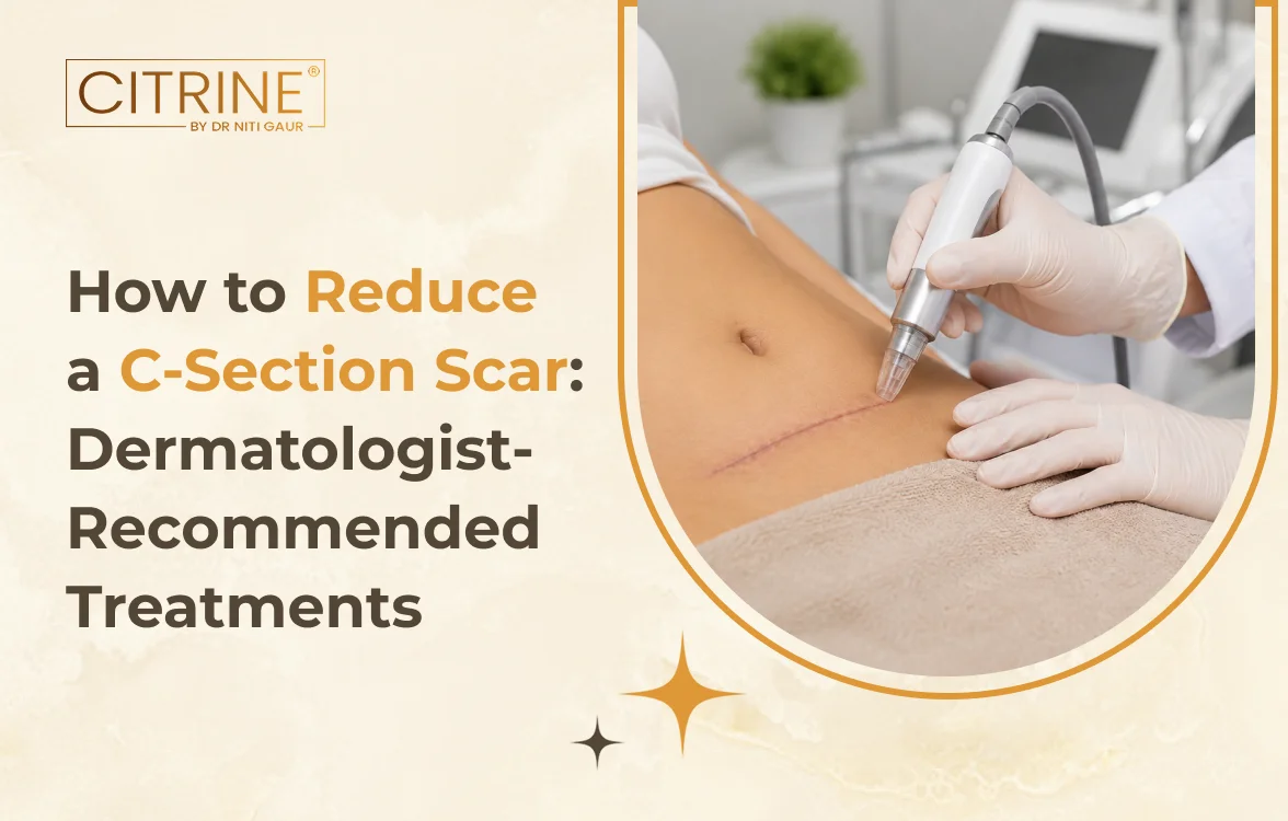 How to Reduce a C-Section Scar: Dermatologist-Recommended Treatments