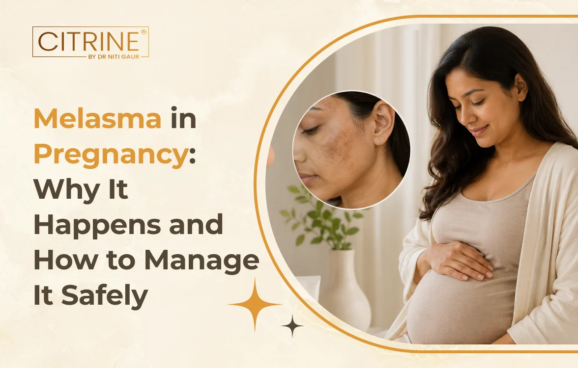 Melasma in Pregnancy: Why It Happens and How to Manage It Safely