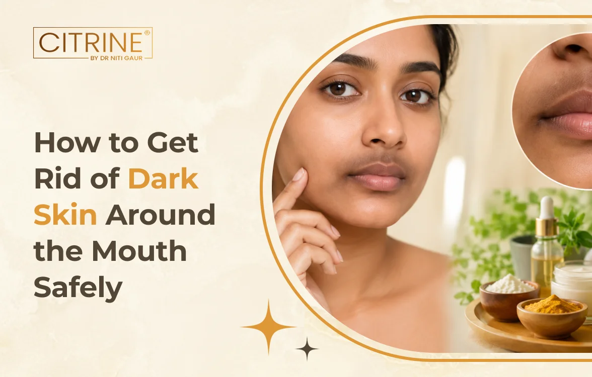 How to Get Rid of Dark Skin Around the Mouth Safely