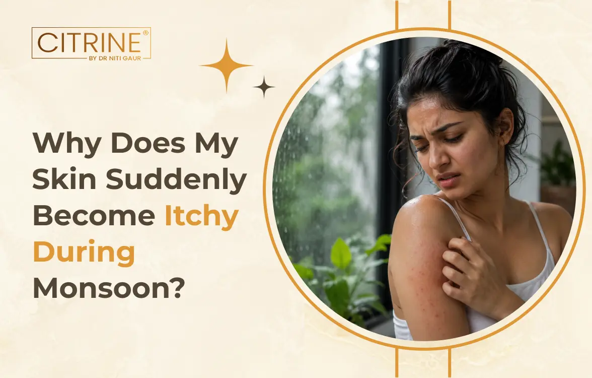 Why Does My Skin Suddenly Become Itchy During Monsoon?