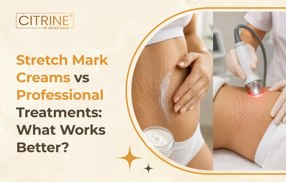 Stretch Mark Creams vs Professional Treatments: What Works Better?