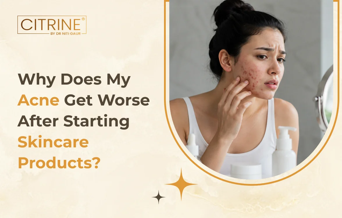Why Does My Acne Get Worse After Starting Skincare Products?