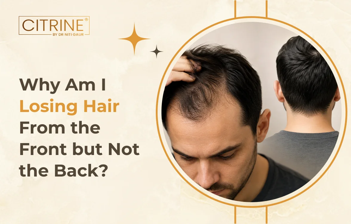Why Am I Losing Hair from the Front but Not the Back?