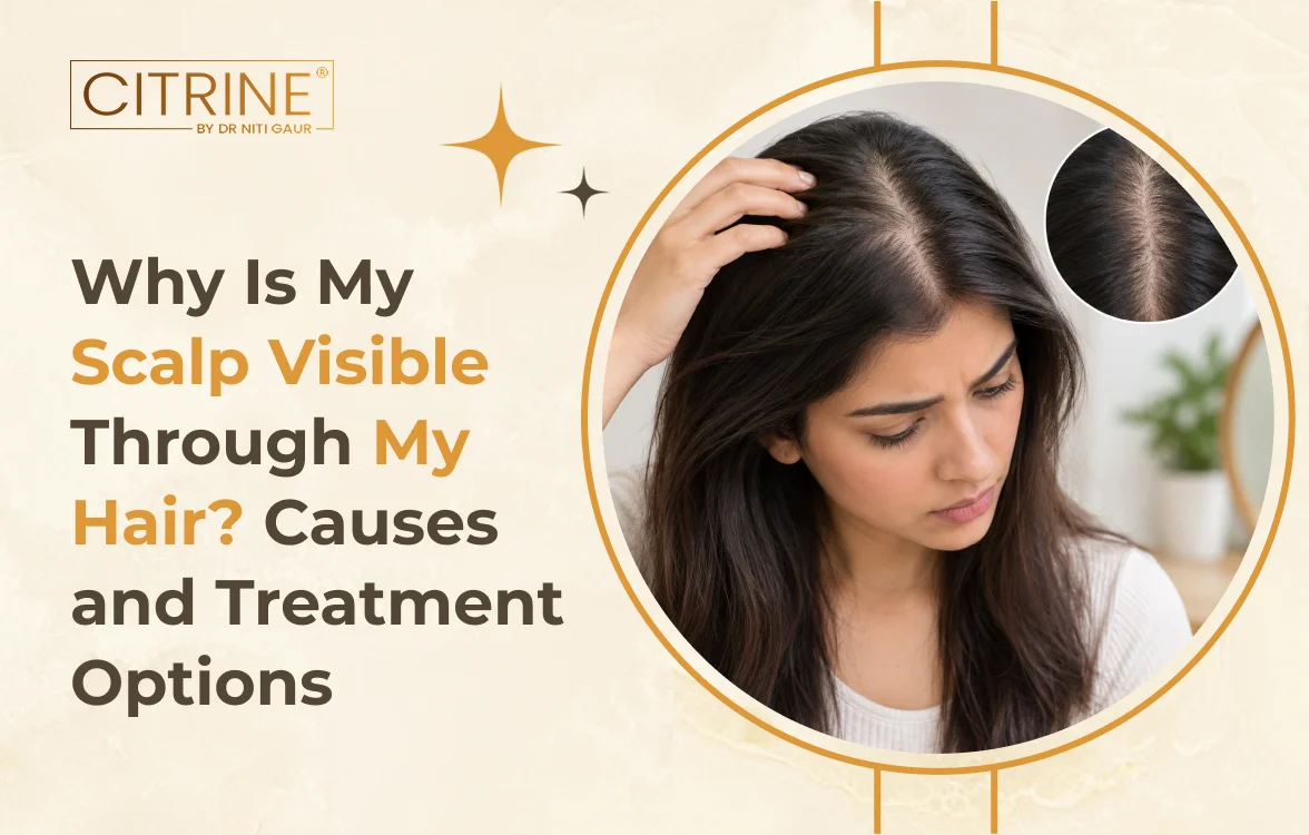 Why Is My Scalp Visible Through My Hair? Causes and Treatment Options