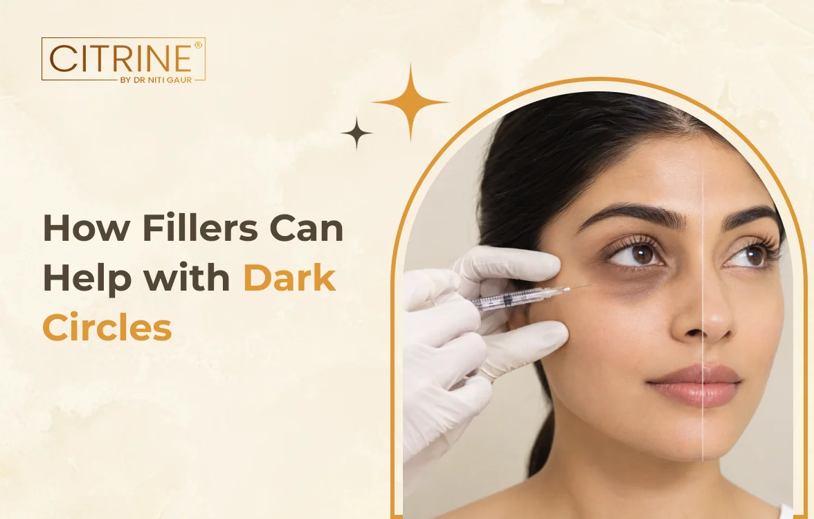 How Fillers Can Help with Dark Circles