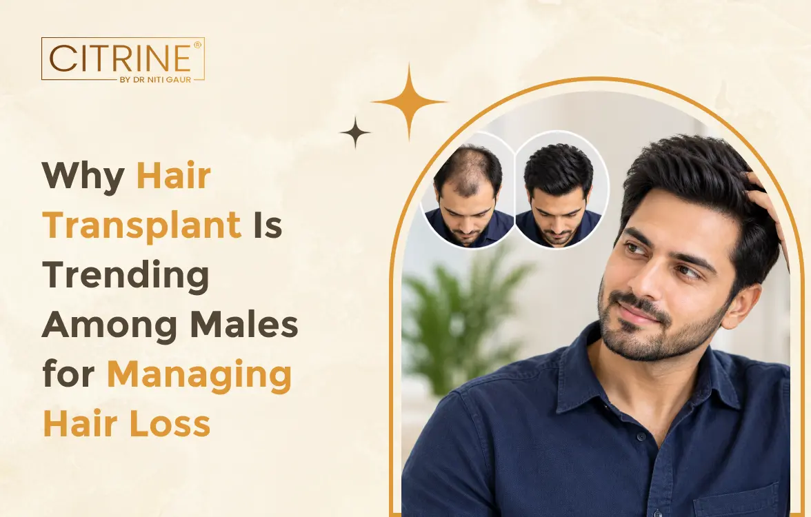 Why Hair Transplant Is Trending Among Males for Managing Hair Loss