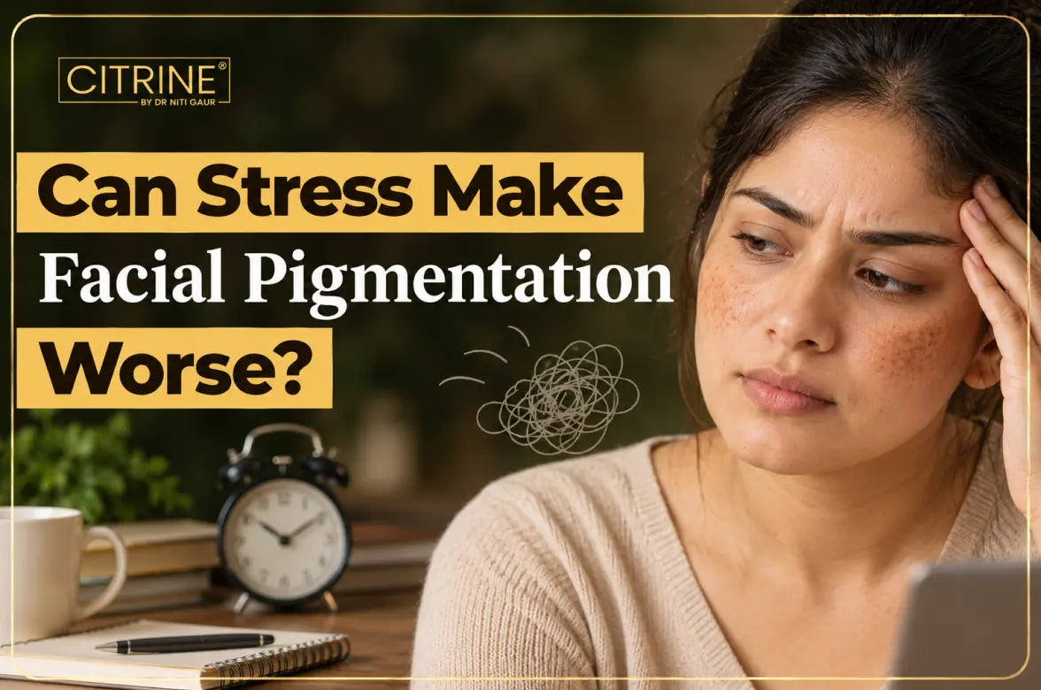 Can Stress Make Facial Pigmentation Worse?