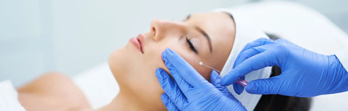 Thread lift Treatment in Gurgaon