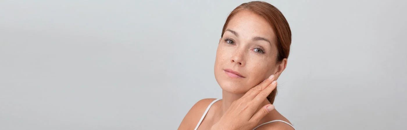 Melasma Treatment in Gurgaon