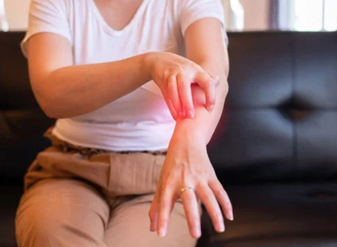Atopic Dermatitis Treatment in Gurgaon