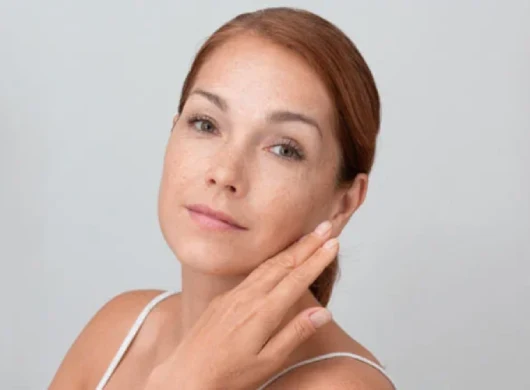 Melasma Treatment in Gurgaon